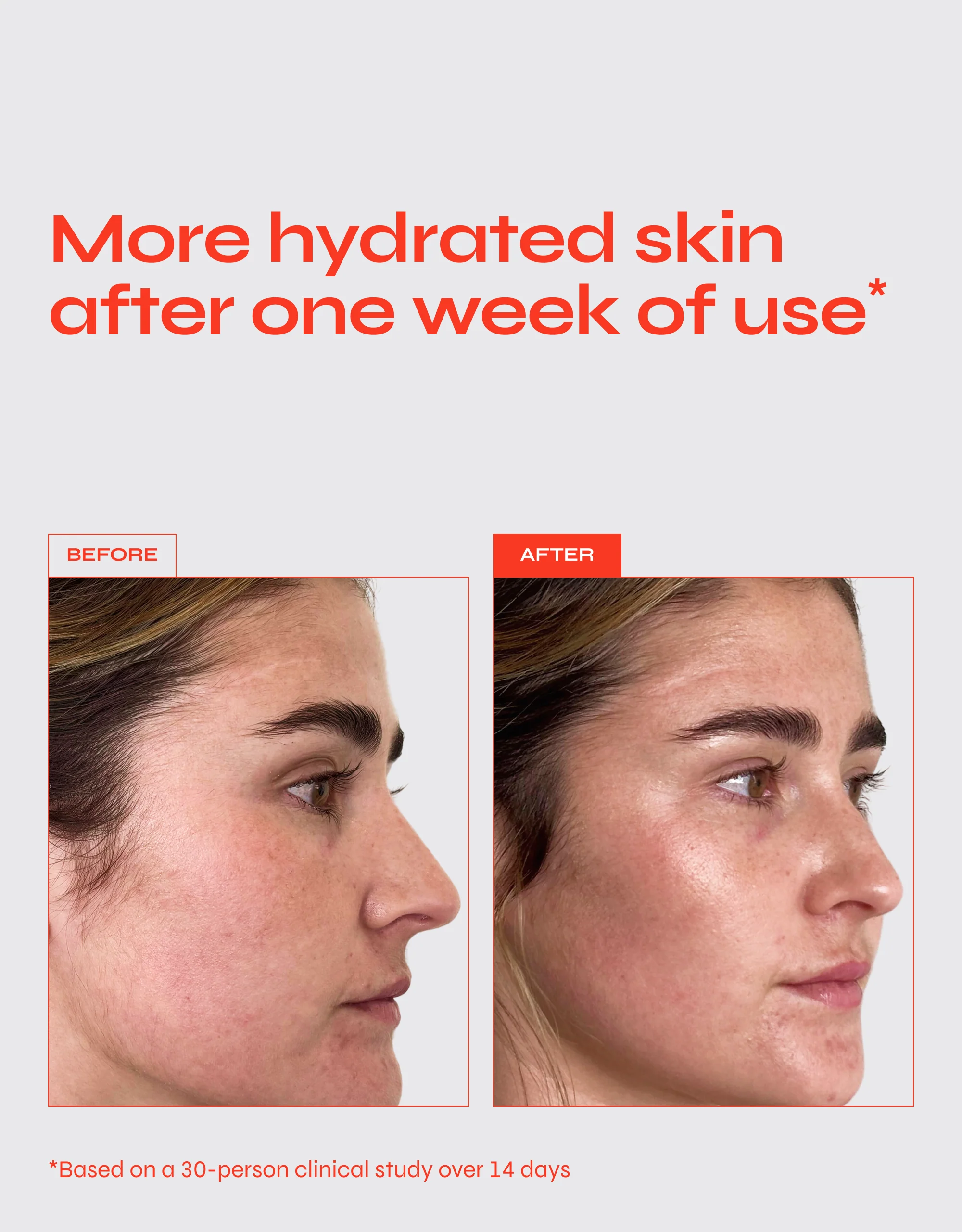 Barely There - Image 4